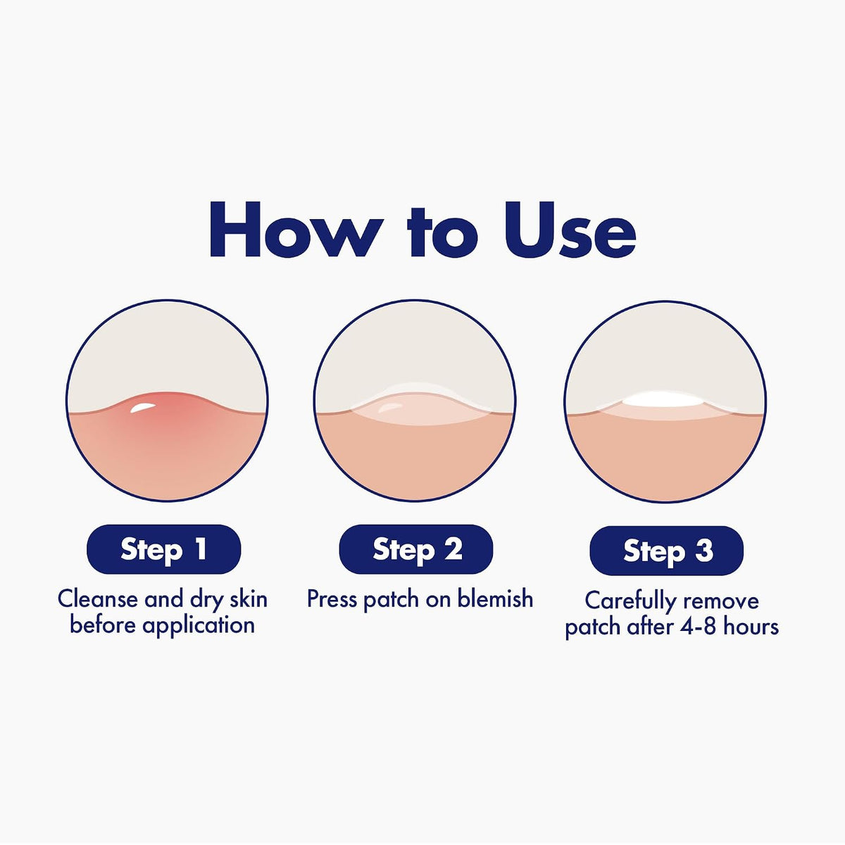 Dermisa Hydrocolloid Spot Patches for Pimples and Breakouts