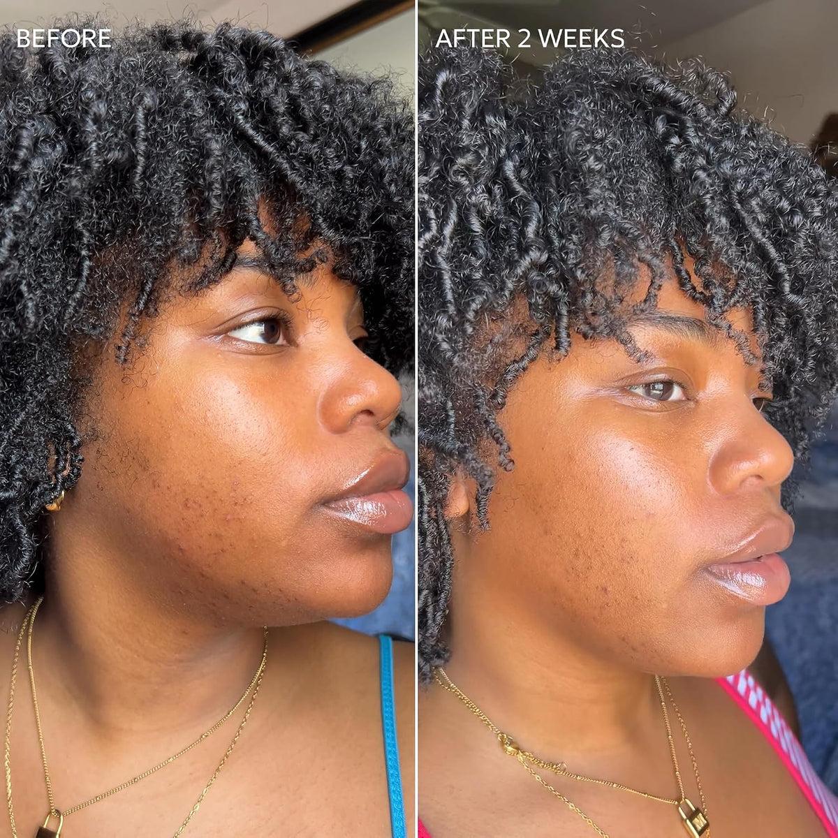 Dermisa Skin Fade Cream - Dark Spot Corrector